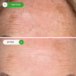 Vitamin C Glow Serum